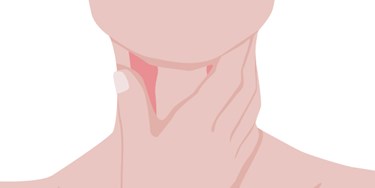 Illustration Person Holding Neck
